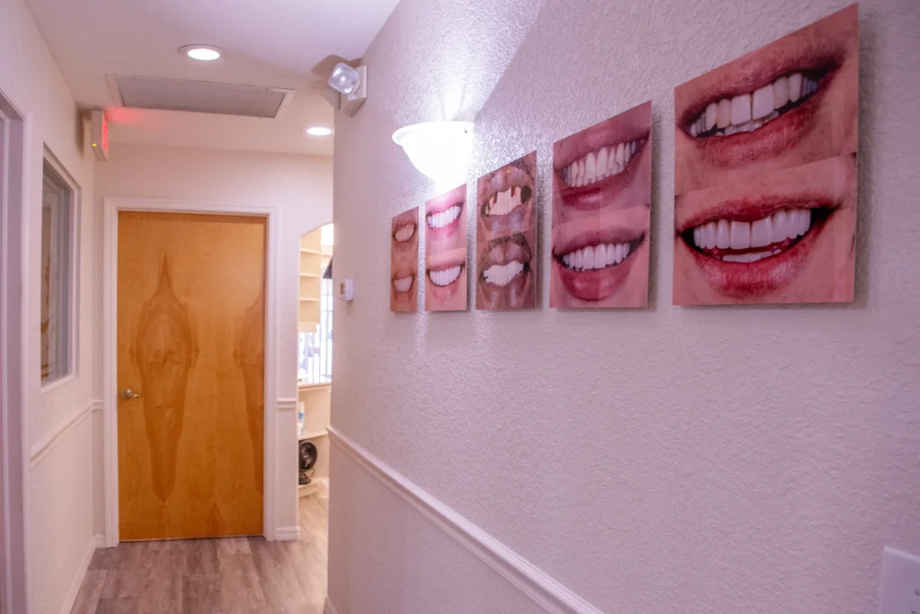 Smile transformation hallway at Dolecki Advanced Dentistry and Implants | Dentist in Punta Gorda, FL